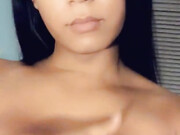 melodymonae-25-11-2019-14883380-Yay I m healing up How is it looking so far